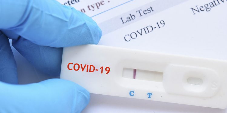 Εδώ μπορείτε να κάνετε δωρεάν rapid test την Παρασκευή